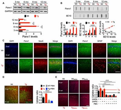 Acute Pannexin 1 Blockade Mitigates Early Synaptic Plasticity Defects in a Mouse Model of Alzheimer’s Disease